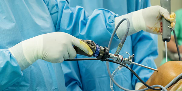 orthopedic doctor instruments - Talent Surgical Instruments